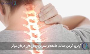 آرتروز گردن