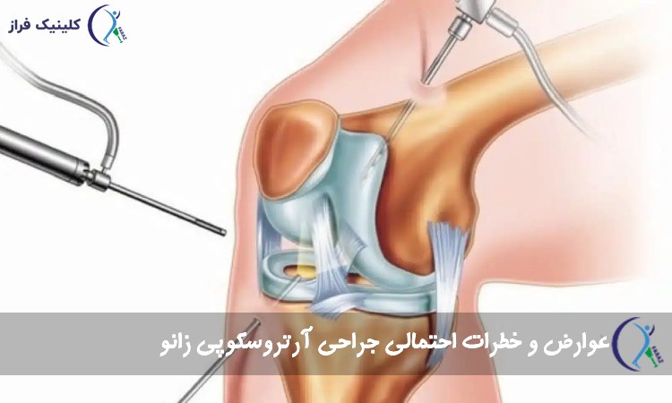 عوارض جراحی آرتروسکوپی