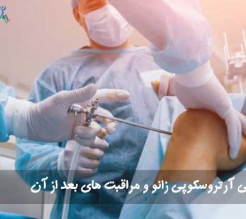 جراحی آرتروسکوپی زانو