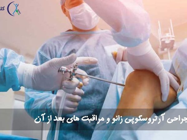 جراحی آرتروسکوپی زانو