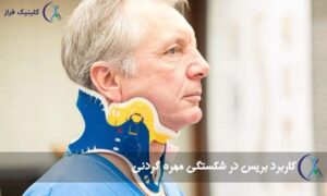 بریس شکستگی گردن