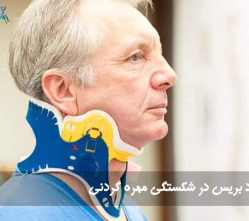 بریس شکستگی گردن