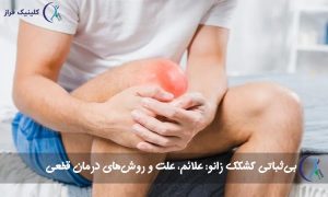 بی‌ثباتی کشکک زانو