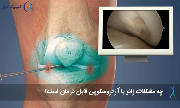 جراحی زانو