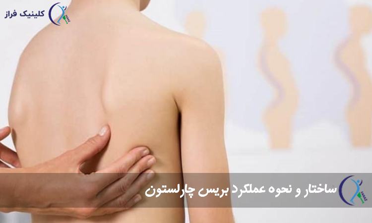 ساختار و نحوه عملکرد بریس چارلستون