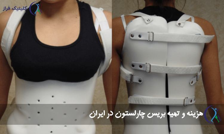 هزینه و تهیه بریس چارلستون در ایران
