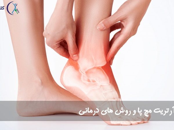 آرتریت مچ پا و روش های درمانی