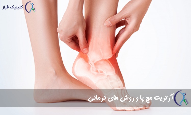 آرتریت مچ پا و روش های درمانی
