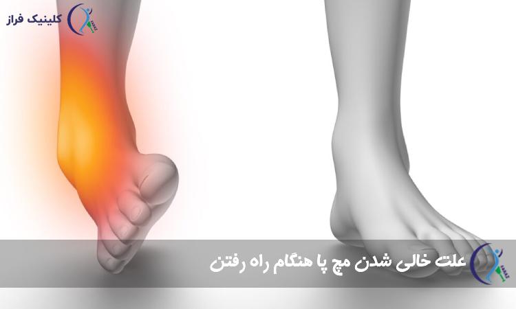 علت خالی شدن مچ پا هنگام راه رفتن