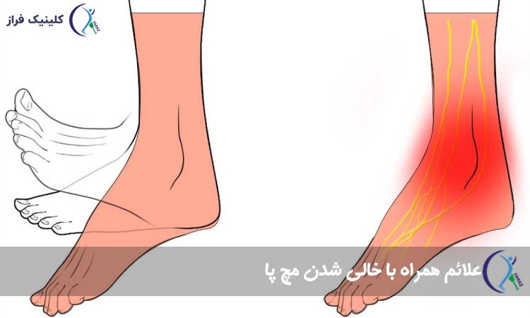 علائم همراه با خالی شدن مچ پا