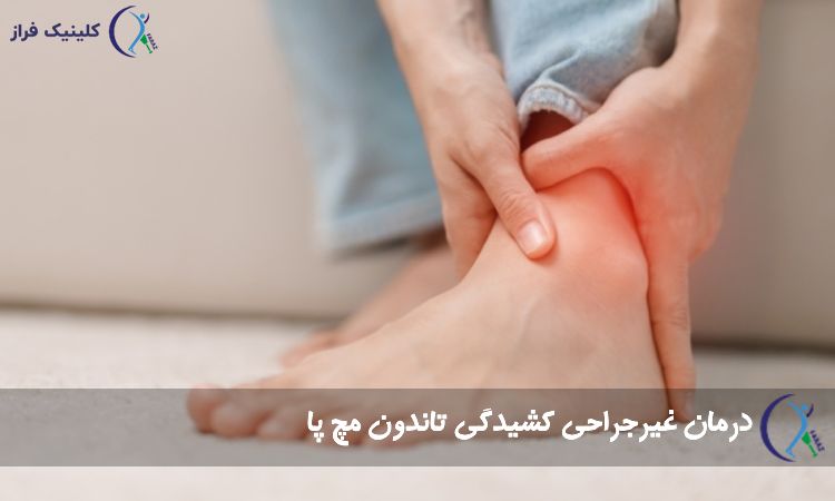 درمان غیرجراحی کشیدگی تاندون مچ پا