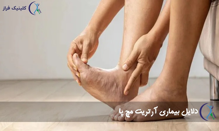 دلایل بیماری آرتریت مچ پا