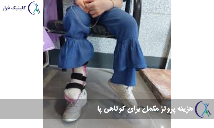 هزینه پروتز مکمل برای کوتاهی پا