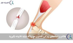 پارگی تاندون مچ پا