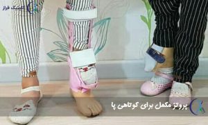 پروتز مکمل برای کوتاهی پا