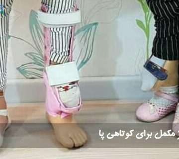 پروتز مکمل برای کوتاهی پا