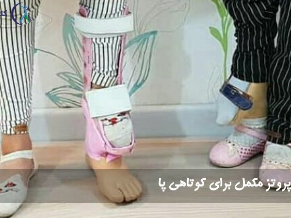 پروتز مکمل برای کوتاهی پا
