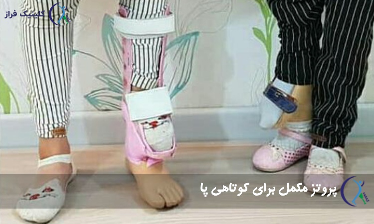 پروتز مکمل برای کوتاهی پا