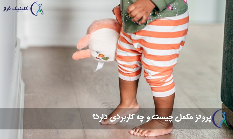 پروتز مکمل چیست و چه کاربردی دارد؟
