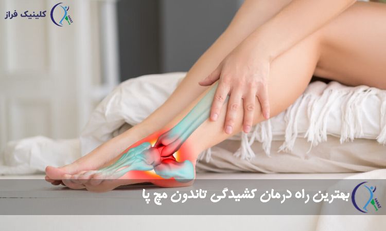 کشیدگی تاندون مچ پا