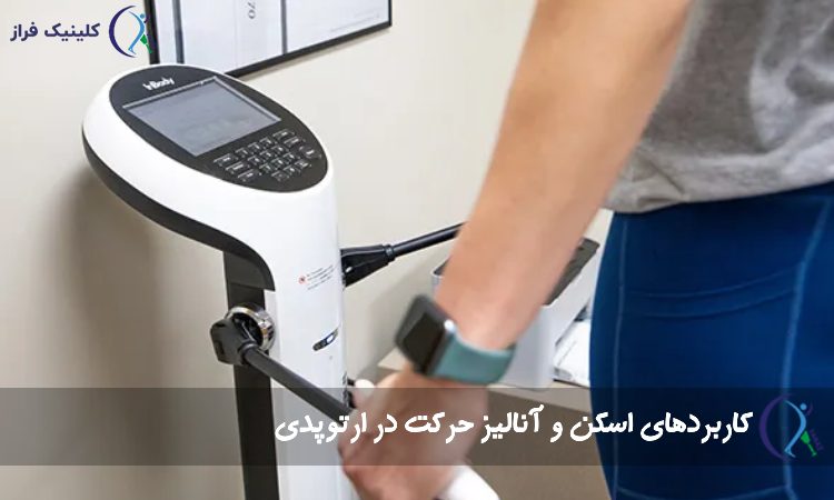 اسکن و آنالیز حرکت