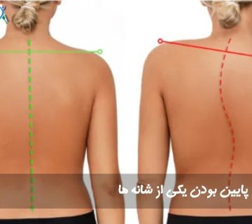 شانه‌های نامتقارن