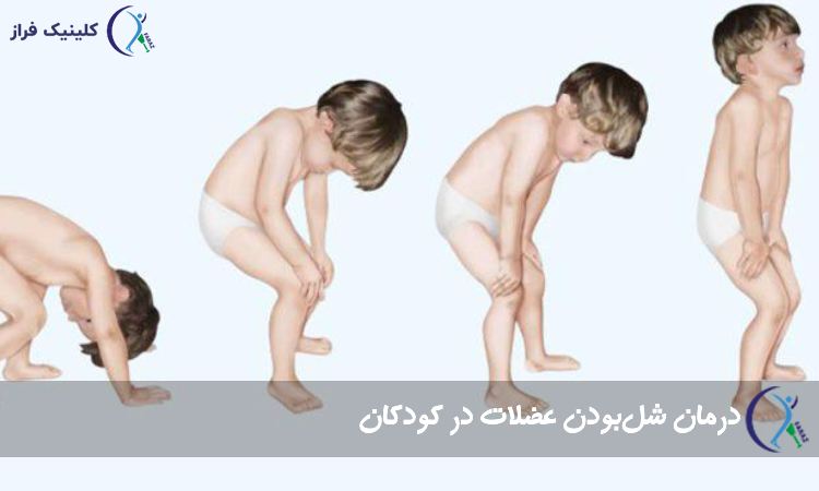 درمان شل‌بودن عضلات در کودکان