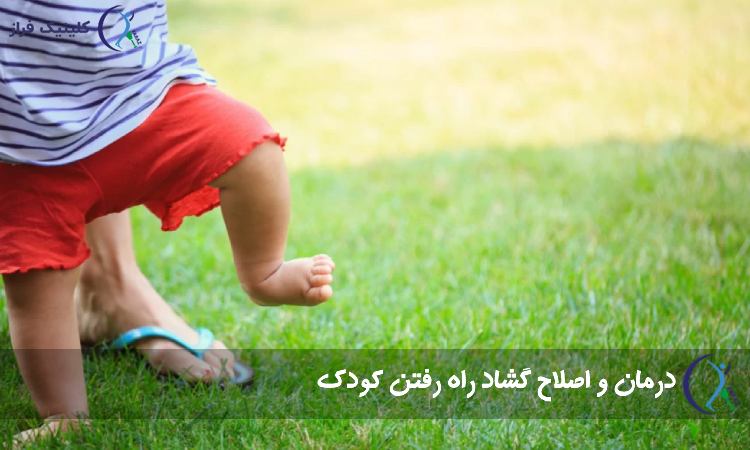 درمان و اصلاح گشاد راه رفتن کودک