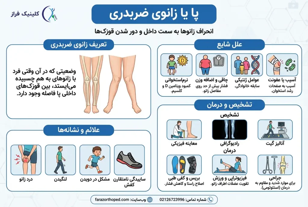 زانوی ضربدری چیست؟علائم علت درمان