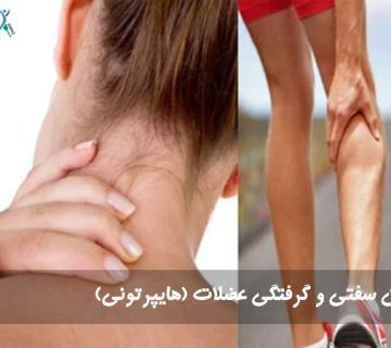 درمان سفتی و گرفتگی عضلات (هایپرتونی)