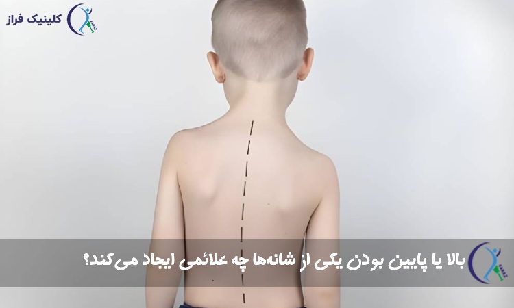 بالا یا پایین بودن یکی از شانهها