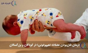 شل‌بودن عضلات یا هیپوتونی