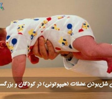 شل‌بودن عضلات یا هیپوتونی