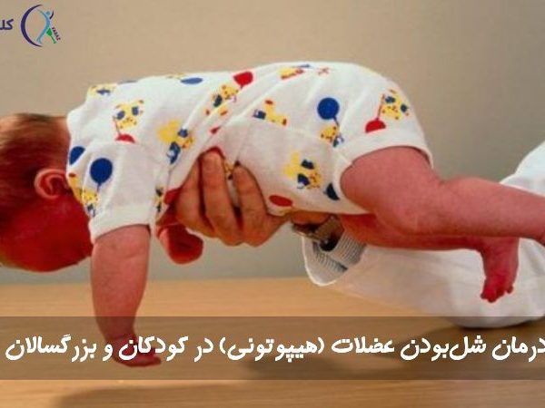 شل‌بودن عضلات یا هیپوتونی