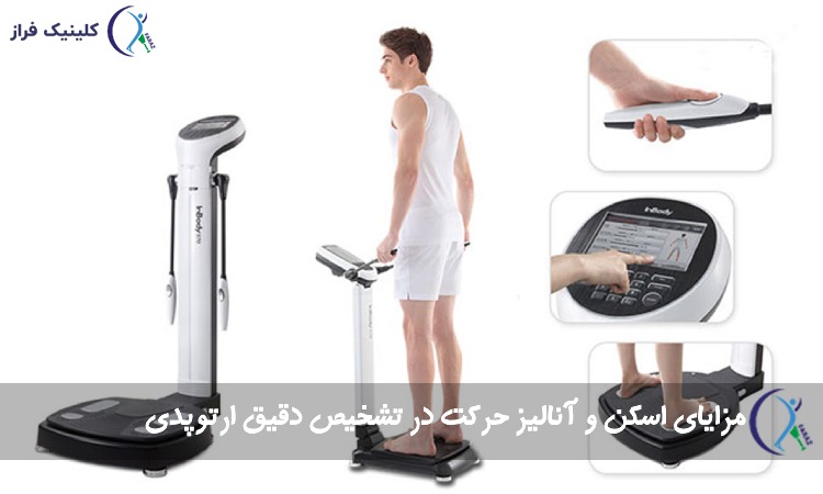 مزایای اسکن و آنالیز حرکت در تشخیص دقیق ارتوپدی