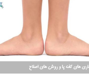 ناهنجاری‌ کف پا