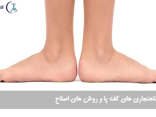 ناهنجاری‌ کف پا