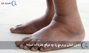 ورم مچ پا