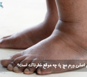 ورم مچ پا
