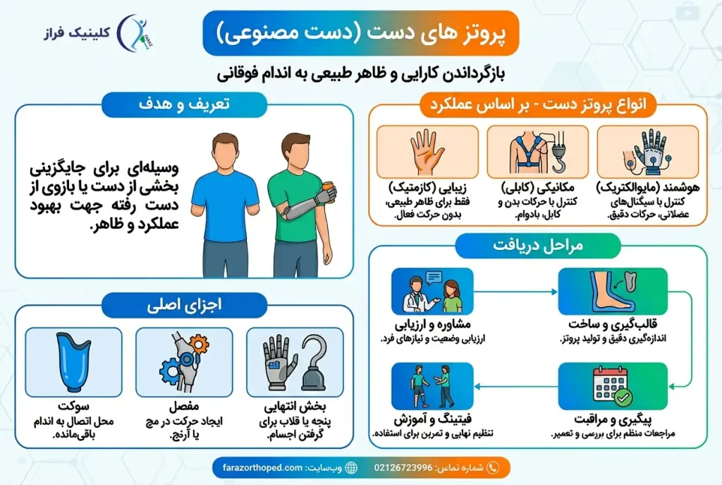 پروتز دست مصنوعی