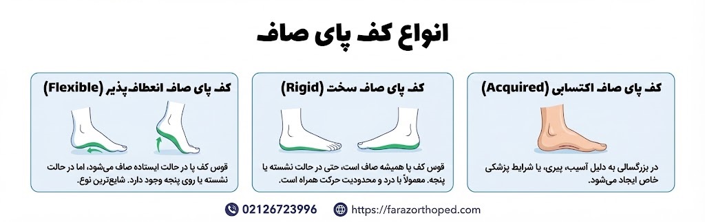 انواع کف پای صاف