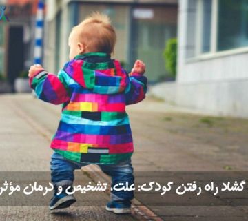 گشاد راه رفتن کودک