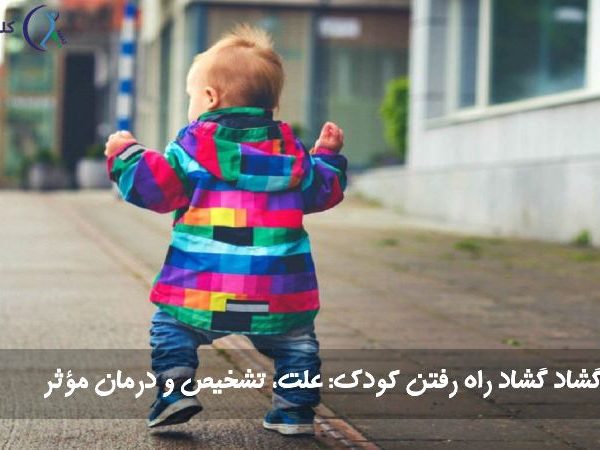 گشاد راه رفتن کودک