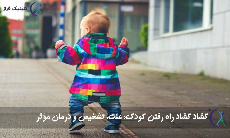 گشاد راه رفتن کودک